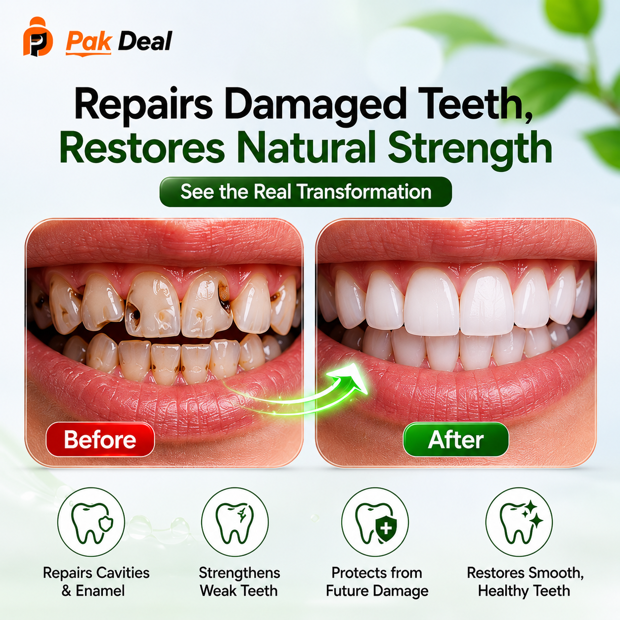 7.5% Nano Hydroxyapatite Toothpaste | Teeth Whitening Formula١ کے ساتھ ١ فری